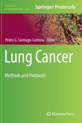 Cáncer de pulmón: Métodos y protocolos - Lung Cancer: Methods and Protocols