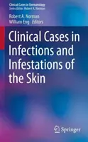 Casos clínicos de infecciones e infestaciones cutáneas - Clinical Cases in Infections and Infestations of the Skin