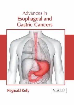 Avances en cánceres de esófago y gástricos - Advances in Esophageal and Gastric Cancers