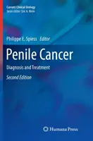 Cáncer de pene: Diagnóstico y Tratamiento - Penile Cancer: Diagnosis and Treatment