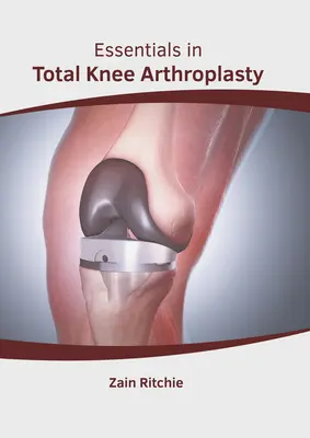 Fundamentos de la artroplastia total de rodilla - Essentials in Total Knee Arthroplasty