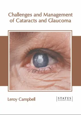 Retos y tratamiento de las cataratas y el glaucoma - Challenges and Management of Cataracts and Glaucoma