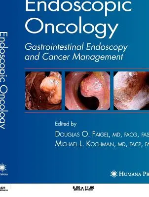 Oncología endoscópica - Endoscopic Oncology