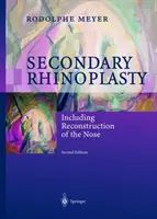 Rinoplastia secundaria: Incluida la reconstrucción de la nariz - Secondary Rhinoplasty: Including Reconstruction of the Nose