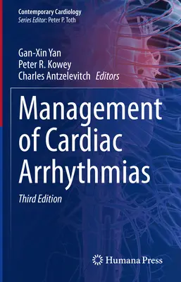 Tratamiento de las arritmias cardíacas - Management of Cardiac Arrhythmias