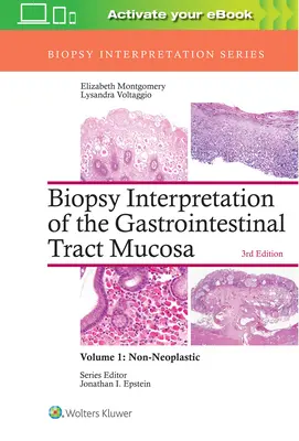 Interpretación de la biopsia de la mucosa del tracto gastrointestinal: Volumen 1: No neoplásica - Biopsy Interpretation of the Gastrointestinal Tract Mucosa: Volume 1: Non-Neoplastic