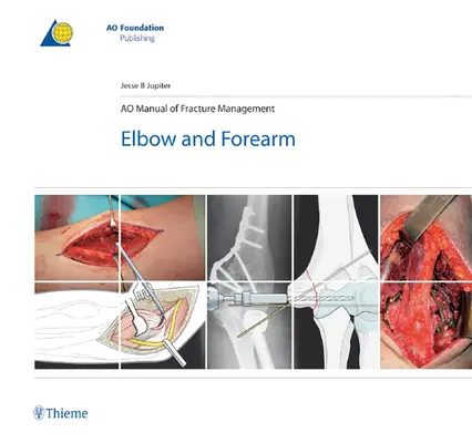 Ao Manual de Tratamiento de Fracturas - Codo y Antebrazo - Ao Manual of Fracture Management - Elbow & Forearm