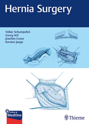 Cirugía de hernia - Hernia Surgery