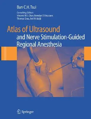 Atlas de anestesia regional guiada por ultrasonidos y estimulación nerviosa - Atlas of Ultrasound and Nerve Stimulation-Guided Regional Anesthesia