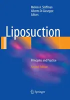 Liposucción: Principios y Práctica - Liposuction: Principles and Practice