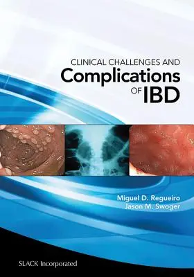 Retos clínicos y complicaciones del Ibd - Clinical Challenges and Complications of Ibd