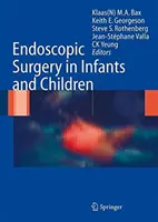 Cirugía endoscópica en lactantes y niños - Endoscopic Surgery in Infants and Children