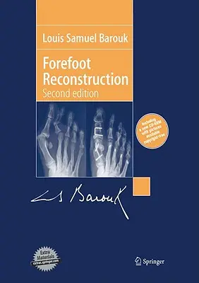 Reconstrucción del antepié - Forefoot Reconstruction