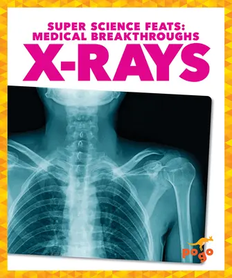 Rayos X - X-Rays