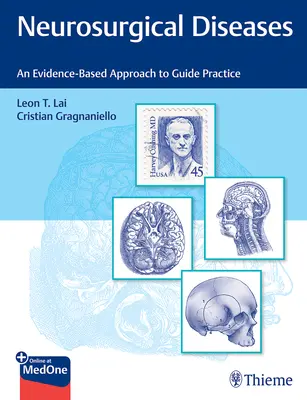 Enfermedades Neuroquirúrgicas: Un Enfoque Basado en la Evidencia para Guiar la Práctica - Neurosurgical Diseases: An Evidence-Based Approach to Guide Practice