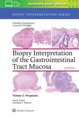 Interpretación de la biopsia de la mucosa del tracto gastrointestinal: Volumen 2: Neoplasia - Biopsy Interpretation of the Gastrointestinal Tract Mucosa: Volume 2: Neoplastic