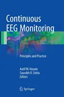 Monitorización EEG continua: Principios y práctica - Continuous Eeg Monitoring: Principles and Practice