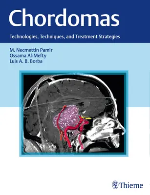 Cordomas: Tecnologías, técnicas y estrategias de tratamiento - Chordomas: Technologies, Techniques, and Treatment Strategies