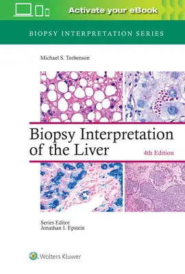 Interpretación de biopsias hepáticas - Biopsy Interpretation of the Liver
