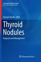Nódulos tiroideos: Diagnóstico y manejo - Thyroid Nodules: Diagnosis and Management