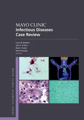 Revisión de casos de enfermedades infecciosas de la Clínica Mayo: Con preguntas y respuestas al estilo de los consejos de administración - Mayo Clinic Infectious Disease Case Review: With Board-Style Questions and Answers