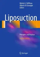 Liposucción: Principios y Práctica - Liposuction: Principles and Practice