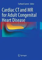 TC y RM cardíacas para cardiopatías congénitas del adulto - Cardiac CT and MR for Adult Congenital Heart Disease