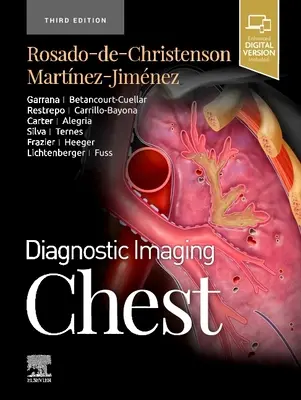 Diagnóstico por imagen: Chest - Diagnostic Imaging: Chest