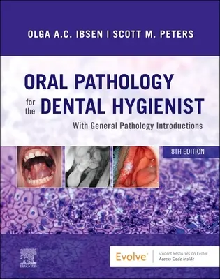 Patología oral para el higienista dental - Oral Pathology for the Dental Hygienist