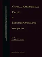 Arritmias cardíacas, marcapasos y electrofisiología: La opinión de los expertos - Cardiac Arrhythmias, Pacing & Electrophysiology: The Expert View