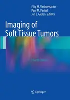 Imágenes de tumores de tejidos blandos - Imaging of Soft Tissue Tumors