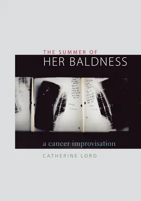 El verano de su calvicie: Una improvisación sobre el cáncer - The Summer of Her Baldness: A Cancer Improvisation