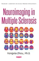 Neuroimagen en la esclerosis múltiple - Neuroimaging in Multiple Sclerosis