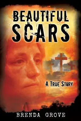 Hermosas cicatrices - Beautiful Scars