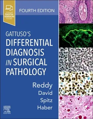 Diagnóstico diferencial de Gattuso en patología quirúrgica - Gattuso's Differential Diagnosis in Surgical Pathology