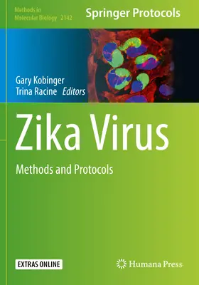 Virus del Zika: Métodos y protocolos - Zika Virus: Methods and Protocols