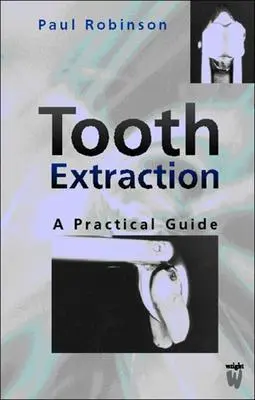 Extracción dental: Guía práctica - Tooth Extraction: A Practical Guide