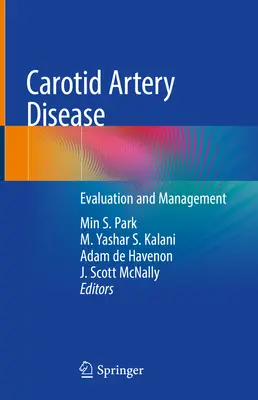 Enfermedad de la arteria carótida: Evaluación y tratamiento - Carotid Artery Disease: Evaluation and Management