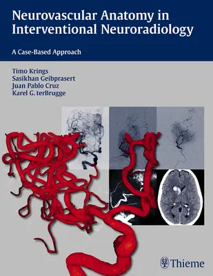 Neurovascular Anatomy in Interventional Neuroradiology: Un enfoque basado en casos - Neurovascular Anatomy in Interventional Neuroradiology: A Case-Based Approach