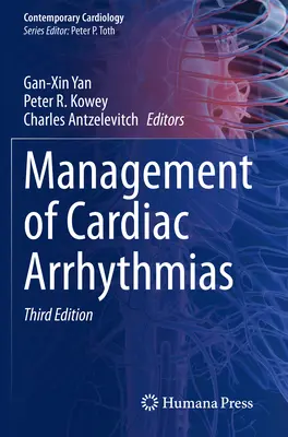 Tratamiento de las arritmias cardíacas - Management of Cardiac Arrhythmias