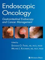 Oncología endoscópica - Endoscopic Oncology