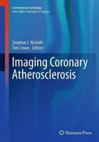 Aterosclerosis coronaria por imágenes - Imaging Coronary Atherosclerosis