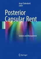 Alquiler capsular posterior: génesis y gestión - Posterior Capsular Rent: Genesis and Management