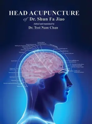 Acupuntura de la cabeza del Dr. Shun Fa Jiao - Head Acupuncture of Dr. Shun Fa Jiao