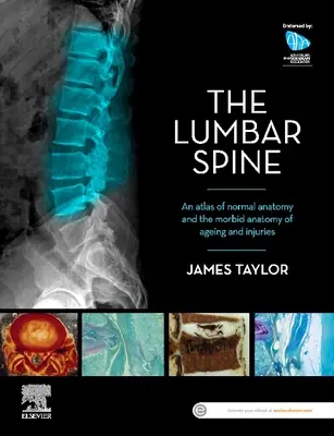 La Columna Lumbar: Atlas de anatomía normal y anatomía mórbida del envejecimiento y las lesiones - The Lumbar Spine: An Atlas of Normal Anatomy and the Morbid Anatomy of Ageing and Injury