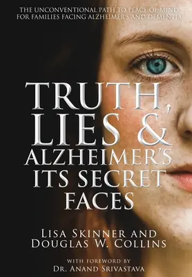 Verdad, mentira y Alzheimer: Sus caras secretas - Truth, Lies & Alzheimer's: Its Secret Faces