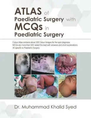 Atlas de Cirugía Pediátrica con Mcqs en Cirugía Pediátrica - Atlas of Paediatric Surgery with Mcqs in Paediatric Surgery