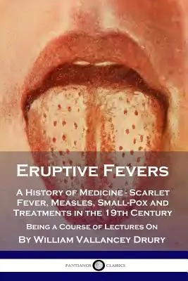 Eruptive Fevers: Historia de la medicina - Fiebre escarlata, sarampión, viruela y tratamientos en el siglo XIX - Curso de conferencias - Eruptive Fevers: A History of Medicine - Scarlet Fever, Measles, Small-Pox and Treatments in the 19th Century - Being a Course of Lectu