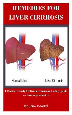 Remedios Para La Cirrosis Hepática: Remedios eficaces para la cirrosis hepática y guía de seguridad sobre cómo proceder - Remedies For Liver Cirrhosis: Effective remedies for liver cirrhosis and safety guide on how to go about it