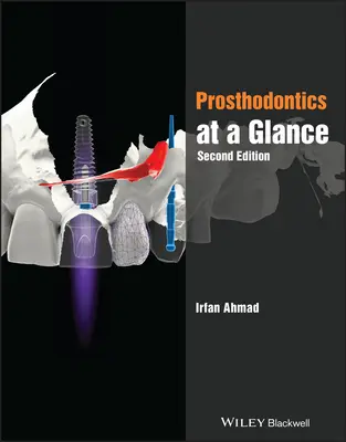 Un vistazo a la prostodoncia - Prosthodontics at a Glance